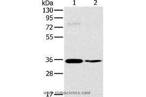 Western blot analysis of 293T and skov3 cell, using OTUB1 Polyclonal Antibody at dilution of 1:570 (OTUB1 Antikörper)