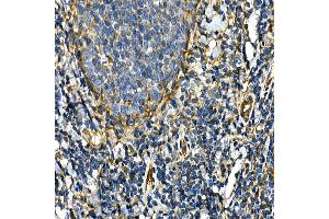 Immunohistochemistry of paraffin-embedded human tonsil using [KO Validated] Integrin alpha 2 (ITG/CD49b) Rabbit pAb (ABIN6133345, ABIN6142558, ABIN6142559 and ABIN7101812) at dilution of 1:50 (40x lens). (ITGA2 Antikörper)