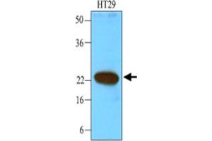 Western blot analysis of cell lysates of HT-29 (40 ug) were resolved by SDS - PAGE , transferred to NC membrane and probed with CIB1 monoclonal antibody , clone 1D1 (1 : 1000) . (CIB1 Antikörper)