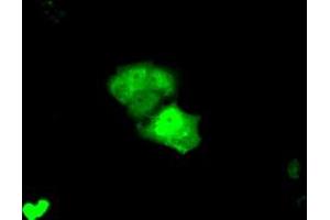Anti-KHK mouse monoclonal antibody (ABIN2453194) immunofluorescent staining of COS7 cells transiently transfected by pCMV6-ENTRY KHK (RC202424). (Ketohexokinase Antikörper)