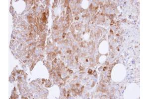 Immunohistochemistry (IHC) image for anti-UDP-N-Acteylglucosamine Pyrophosphorylase 1 (UAP1) antibody (ABIN2855661)