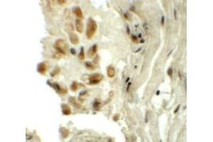 Immunohistochemistry (IHC) image for anti-tRNA-YW Synthesizing Protein 1 Homolog (TYW1) (C-Term) antibody (ABIN1030788) (TYW1 Antikörper  (C-Term))