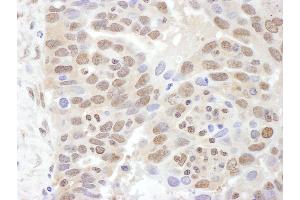 Immunohistochemistry (IHC) image for anti-Proteasome (Prosome, Macropain) 26S Subunit, ATPase, 2 (PSMC2) (AA 150-200) antibody (ABIN7454964)