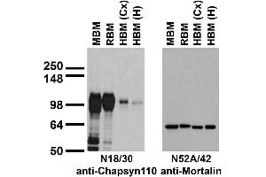 Immunoblot against crude membranes from whole adult mouse brain (MBM) or rat brain (RBM) and from human cerebral cortex [HBM(Cx)] or hippocampus [HBM(H)] probed with N18/30 (left) or N52A/42 (right) TC supe. (DLG2 Antikörper  (AA 1-852))