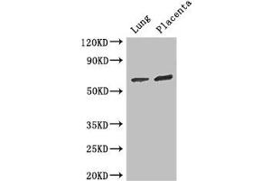 Western Blot Positive WB detected in: Mouse lung tissue, Human placenta tissue All lanes: STAU1 antibody at 3 μg/mL Secondary Goat polyclonal to rabbit IgG at 1/50000 dilution Predicted band size: 64, 55, 56 kDa Observed band size: 64 kDa