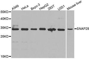 Western blot analysis of extracts of Jurkat cell line, using SNAP29 antibody.