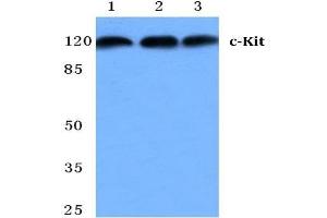 Western blot analysis of CD117/c-Kit antibody at 1/500 dilution in: Lane 1: MCF-7 cell lysate. (KIT Antikörper)