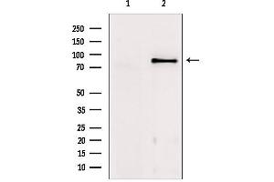 Western blot analysis of extracts from mouse brain, using TACC1 Antibody. (TACC1 Antikörper  (N-Term))