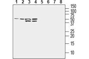 Western blot analysis of human MDA-MB-231 breast adenocarcinoma cell line lysate (lanes 1 and 5), human HepG2 hepatocellular carcinoma cell line lysate (lanes 2 and 6), human K562 chronic myeloid leukemia cell line lysate (lanes 3 and 7) and human Jurkat T-cell leukemia cell line lysate (lanes 4 and 8): - 1-4. (GLUT1 Antikörper  (Extracellular))