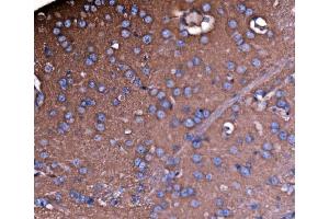 IHC analysis of NEAS/SPTAN1 using anti-NEAS/SPTAN1 antibody (ABIN7600436). (SPTAN1 Antikörper  (AA 1916-2472))