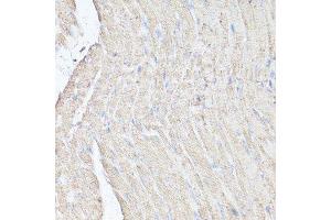 Immunohistochemistry (Paraffin-embedded Sections) (IHC (p)) image for anti-Mechanistic Target of Rapamycin (serine/threonine Kinase) (mTOR) (AA 2400-2500) antibody (ABIN6144170)