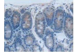 Detection of CEACAM1 in Rat Intestine Tissue using Polyclonal Antibody to Carcinoembryonic Antigen Related Cell Adhesion Molecule 1 (CEACAM1) (CEACAM1 Antikörper  (AA 36-145))