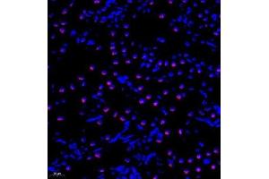 Immunofluorescence analysis of paraffin embedded rat kidney using TIP49A (ABIN7075488) at dilution of 1: 300 (RUVBL1 Antikörper)