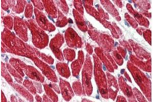 Human Heart (formalin-fixed, paraffin-embedded) stained with TNNI3 antibody ABIN334276 at 2. (TNNI3 Antikörper)