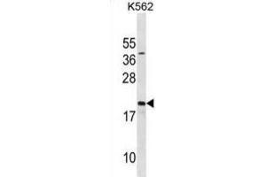 Western Blotting (WB) image for anti-Activated RNA Polymerase II Transcriptional Coactivator p15 (SUB1) antibody (ABIN3001149) (SUB1 Antikörper)