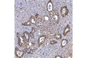 IHC analysis of TRMT2B using anti-TRMT2B antibody (ABIN7599456). (TRMT2B Antikörper  (AA 1-504))