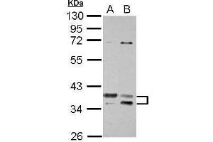 WB Image Sample (30 ug of whole cell lysate) A: Jurkat B: K562 10% SDS PAGE antibody diluted at 1:1000 (TSFM Antikörper)