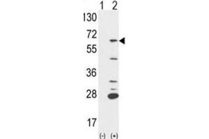 Western Blotting (WB) image for anti-Protein-tyrosine Phosphatase 1C (PTPN6) antibody (ABIN5021218) (SHP1 Antikörper)