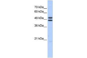 WB Suggested Anti-ERCC8 Antibody Titration: 0. (ERCC8 Antikörper  (Middle Region))