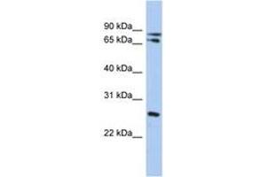 Image no. 1 for anti-Ovo-Like 2 (OVOL2) (C-Term) antibody (ABIN6742352) (OVOL2 Antikörper  (C-Term))