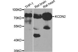 Western Blotting (WB) image for anti-Potassium Voltage-Gated Channel, Shal-Related Subfamily, Member 2 (KCND2) antibody (ABIN1882330) (KCND2 Antikörper)