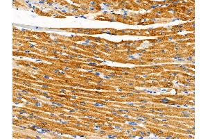 anti-Salt-Inducible Kinase 2 (SIK2) (pSer358) antibody