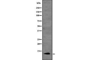 Western blot analysis of CCL20 expression in HEK293 cells ,The lane on the left is treated with the antigen-specific peptide. (CCL20 Antikörper  (Internal Region))