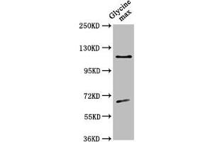 Western Blot Positive WB detected in: Glycine max leaf tissue All lanes: CESA4 antibody at 1:500 Secondary Goat polyclonal to rabbit IgG at 1/50000 dilution Predicted band size: 120 kDa Observed band size: 120 kDa (CESA4 Antikörper  (Catalytic Subunit 4))