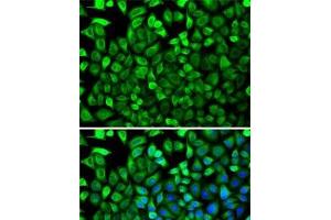 Immunofluorescence (IF) image for anti-Cytidine Deaminase (CDA) antibody (ABIN7257523)
