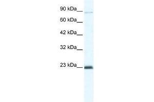 MCM4 antibody used at 5 ug/ml to detect target protein. (MCM4 Antikörper  (C-Term))
