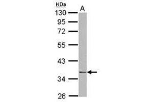 Image no. 1 for anti-NudE Neurodevelopment Protein 1 (NDE1) (AA 1-203) antibody (ABIN1499654) (NudE Neurodevelopment Protein 1 (NDE1) (AA 1-203) Antikörper)