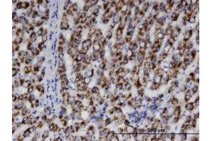 Image no. 1 for anti-Acetyl-CoA Acyltransferase 1 (ACAA1) (AA 217-316) antibody (ABIN599345) (ACAA1 Antikörper  (AA 217-316))