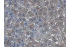 DAB staining on IHC-P; Samples: Rat Liver Tissue (AGXT Antikörper  (AA 182-371))
