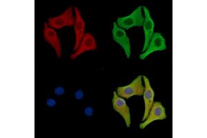ABIN7096982 and ABIN7101049 staining Hela cells by IF/ICC.