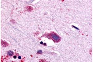 Anti-NTSR1 antibody  ABIN1049156 IHC staining of human brain, neurons and glia. (NTSR1 Antikörper  (C-Term))