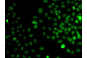 Immunofluorescence analysis of A549 cell using TRPS1 antibody. (TRPS1 Antikörper)
