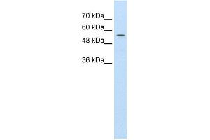 WB Suggested Anti-ABCD4 Antibody Titration:  1. (ABCD4 Antikörper  (C-Term))