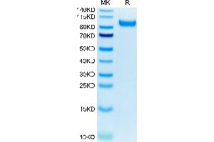 Mouse HGFA (pro form) on Tris-Bis PAGE under reduced condition. (HGFA Protein (AA 35-653) (His tag))