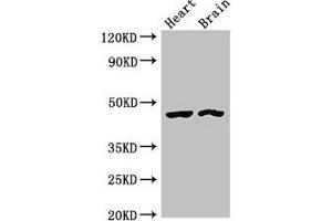 Western Blot Positive WB detected in: Rat heart tissue, Mouse brain tissue All lanes: CTH antibody at 4 μg/mL Secondary Goat polyclonal to rabbit IgG at 1/50000 dilution Predicted band size: 45, 40, 42 kDa Observed band size: 45 kDa (CTH Antikörper  (AA 1-70))