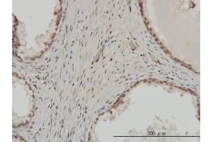 Image no. 1 for anti-Zinc Finger Protein 202 (ZNF202) (AA 301-401) antibody (ABIN599015) (ZNF202 Antikörper  (AA 301-401))
