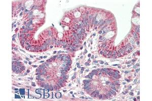 ABIN5539911 (5µg/ml) staining of paraffin embedded Human Small Intestine.