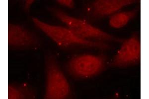Immunofluorescence staining of methanol-fixed HeLa cells using c-Abl (phospho-Tyr412) antibody. (ABL1 Antikörper  (pTyr412))