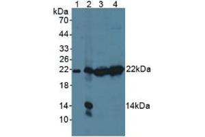Figure. (PSMB9 Antikörper  (AA 22-219))