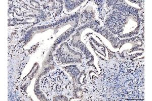 IHC analysis of TPR using anti-TPR antibody (ABIN7603243). (TPR Antikörper  (N-Term))