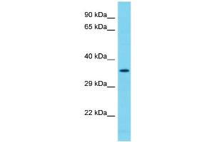 Host: Rabbit Target Name: NDUFAF7 Sample Type: 293T Whole Cell lysates Antibody Dilution: 1.