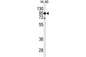 Western blot analysis of TLR4 Antibody (Center) in HL-60 cell line lysates (35 µg/lane). (TLR4 Antikörper  (Middle Region))