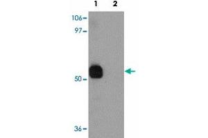 Western blot analysis of SPTLC2 in NIH/3T3 cell lysate with SPTLC2 polyclonal antibody  at 1 ug/mL in (1) the absence and (2) the presence of blocking peptide. (SPTLC2 Antikörper  (C-Term))