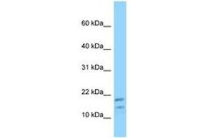 Image no. 1 for anti-Diazepam Binding Inhibitor (DBI) (N-Term) antibody (ABIN6748198) (Diazepam Binding Inhibitor Antikörper  (N-Term))