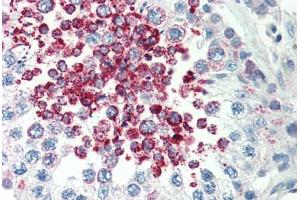 anti-Caspase Recruitment Domain Family, Member 10 (CARD10) (C-Term) antibody