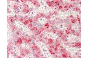 Immunohistochemistry (IHC) image for anti-ADAM Metallopeptidase with Thrombospondin Type 1 Motif, 13 (ADAMTS13) (AA 250-350) antibody (ABIN2614462)